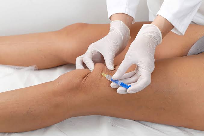 Knee Pain Treatment Chennai